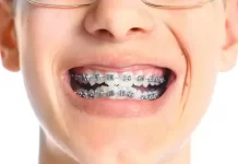 Orthodontics: Straightening Up Your Smile with Style